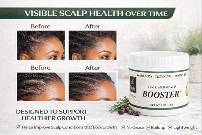 Hairobics Hair & Scalp Booster – Natural Hair Growth Product for Thinning Hair, Dry Scalp & Edges | Strengthens Roots, Promotes Growth & Nourishes Scalp | 4 oz