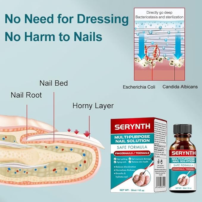 Toenail Fungus Treatment Extra Strength, Upgraded Toe Nail Fungus Treatments, Fungus Nail Treatment, Toe Fungus Treatment for Toenail, Safely and Gently 1 Fl Oz