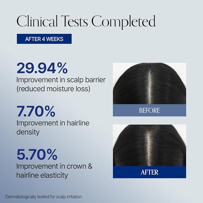 GROWUS Recover Therapy Hair Booster Serum EX - Biotin Spicule & Triple-Ball Scalp Massager for Thinning Hair - Root Strengthening Scalp Serum for Thicker, Fuller Hair - 14ml (0.47 fl.oz)