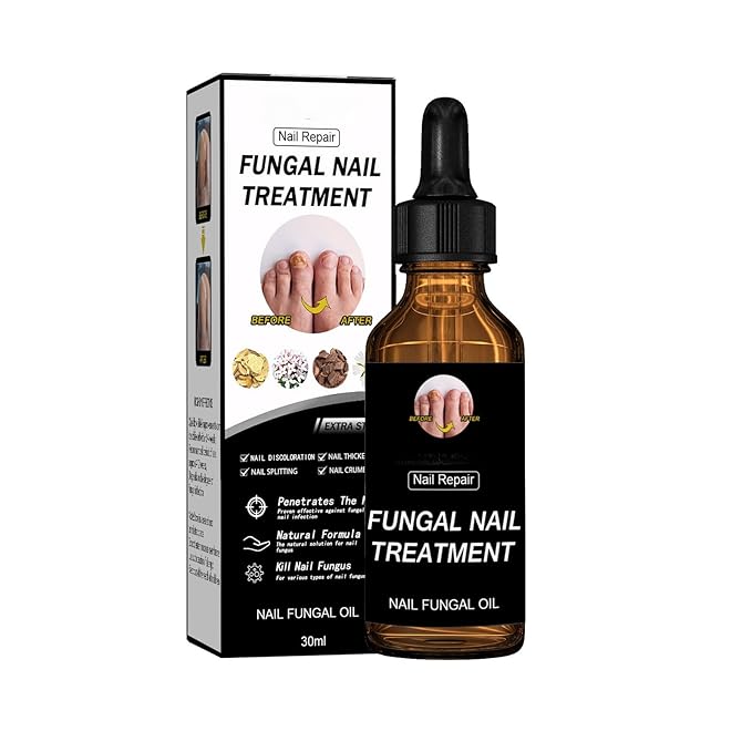 Fungal Nail Treatment Repairs Nail Discoloration and Thickness, nail fungus treatment extra strength 30ml 2PCS