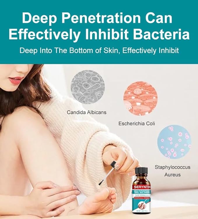 Toenail Fungus Treatment Extra Strength, Upgraded Toe Nail Fungus Treatments, Fungus Nail Treatment, Toe Fungus Treatment for Toenail, Safely and Gently 1 Fl Oz