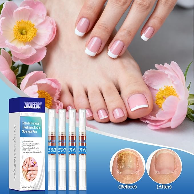 Nail Fungus Pen,4 Pack Nail Treatment Pen，Treatment Extra Strength for Toenail & Fingernails，Fast-Acting Solution for Broken& Discolored Nails