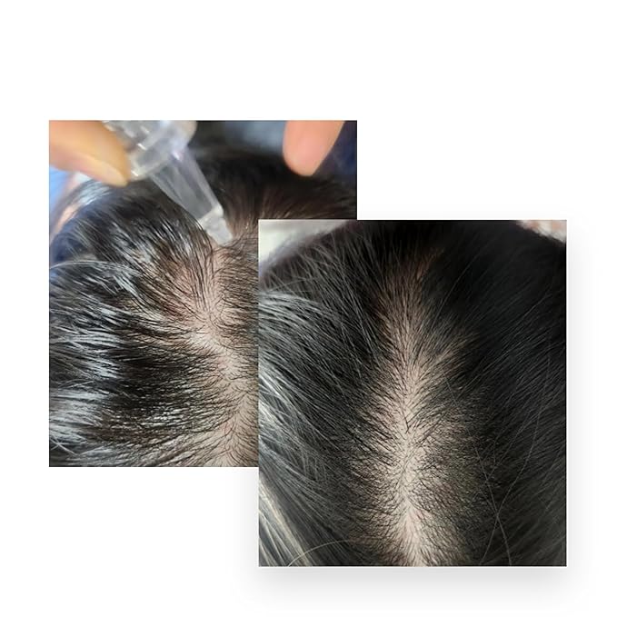 CELONIA 574H Bio Cell Care Hair Booster, Anti Hair Loss Cell Growth Factors Treatment, Stem Cell Serum For Hair Regrowth & Healthy Scalp, Intensive Care For Scalp, Crown & Hairline (5MLx10 Vials)