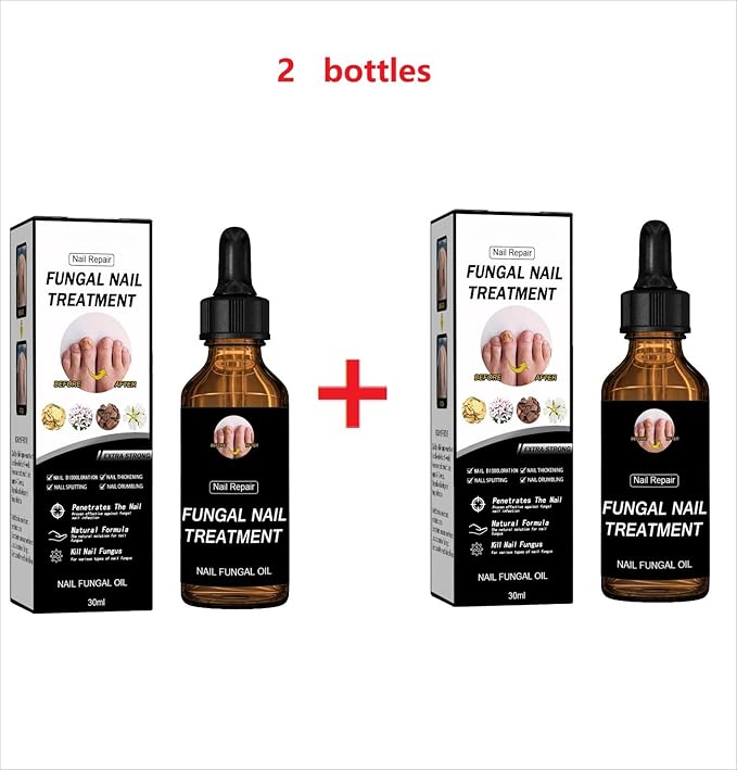 Fungal Nail Treatment Repairs Nail Discoloration and Thickness, nail fungus treatment extra strength 30ml 2PCS