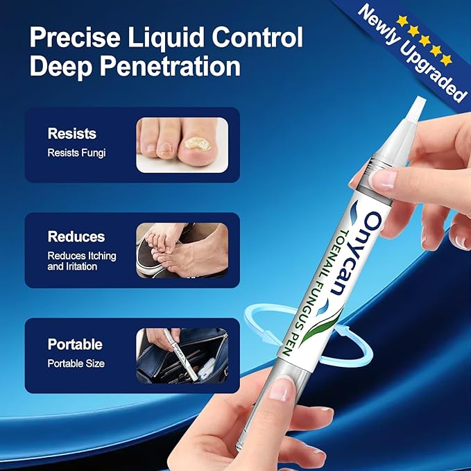 Toenail Fungus Treatment Extra Strength With 25% Undecylenic Acid - Nail Fungus Treatment Extra Strength Pen For Thick, Yellow, Brittle, Discolored Toenails & Fingernails Toenail And Fingernail Repair