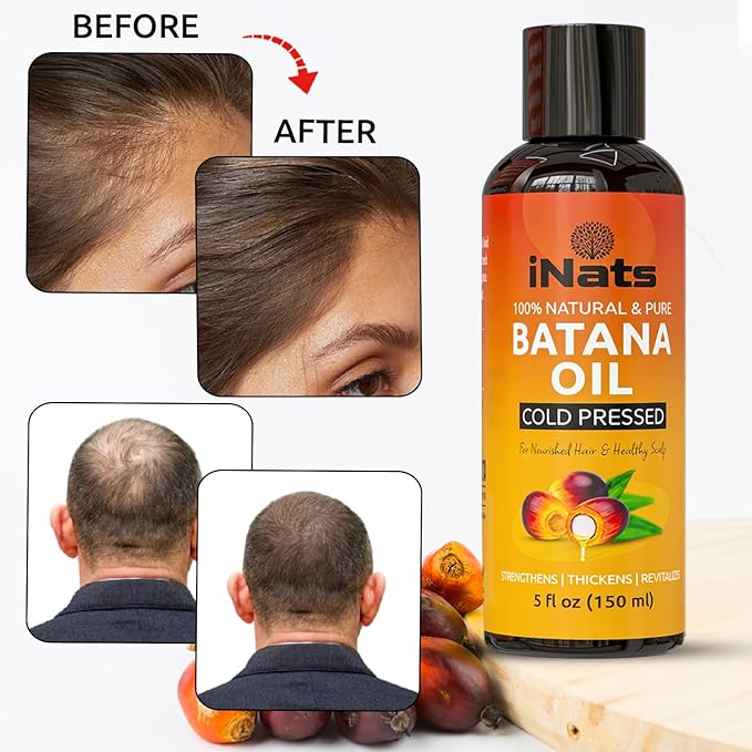 Premium Raw Batana Oil for Hair Growth (5 Fl Oz) - Dr. Sebi 100％ Pure & Batana Hair Growth Oil from Honduras - Organic & Natural - Deeply Nourishing Scalp for Thicker & Stronger Hair for Women & Men