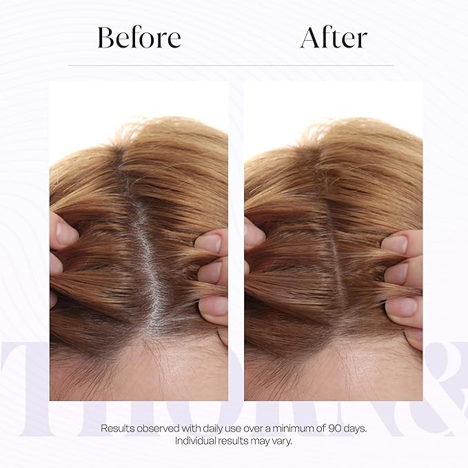 Scalp Serum For Thinning Hair & Density Booster | 3 Key Peptides | Thicker Fuller Hair Thickening Serum With Rosemary Oil, Topical Caffeine, Saw Palmetto, Biotin, Peppermint | Strengthening Treatment
