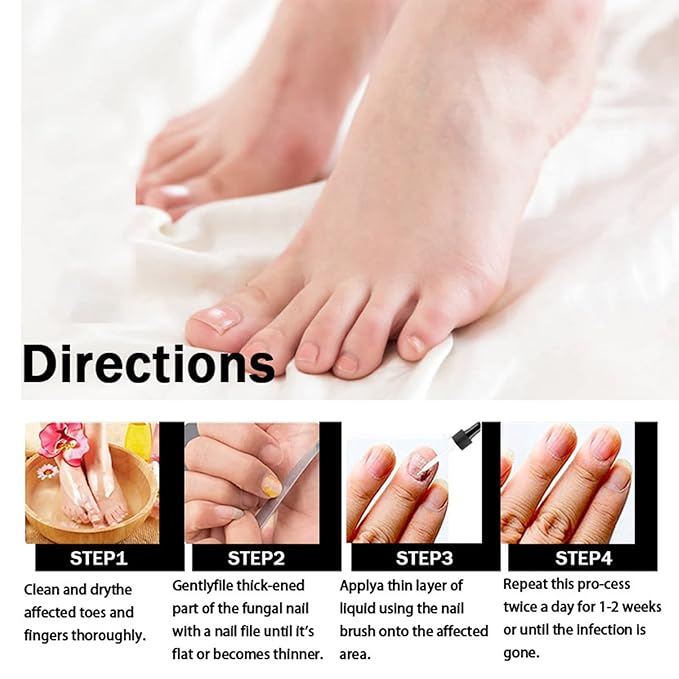 Fungal Nail Treatment Repairs Nail Discoloration and Thickness, nail fungus treatment extra strength 30ml 2PCS