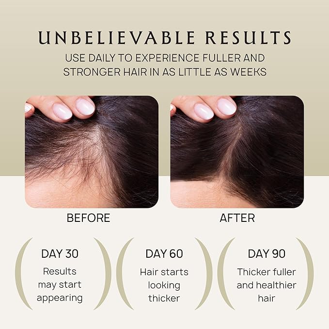 Lebanta Hair Growth Oil Spray - 100% Pure Ingredients For Non Greasy, Thicker & Stronger Hair - Organic Batana, Castor, Biotin, Saw Palmetto, and Rosemary Oil Gifts Women Scalp (4.1 Fl Oz (Pack of 2))