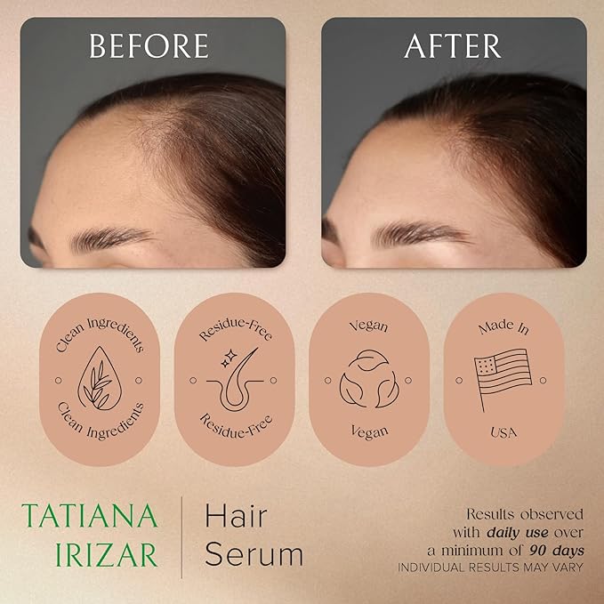 Caffeine Hair Growth Serum Women Made in USA - Scalp Serum Hair Growth Non-Greasy Biotin Rosemary, Amla & Caffeine - 1 Fl.Oz Natural Residue-Free - Gotero Anticaida y Crecimiento - Regrowth Treatment