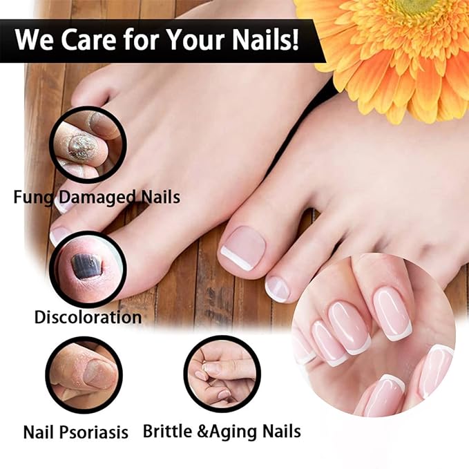 Fungal Nail Treatment Repairs Nail Discoloration and Thickness, nail fungus treatment extra strength 30ml 2PCS