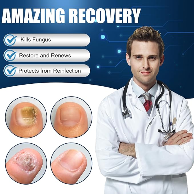 Toenail Fungus Treatment Extra Strength,Nail Fungus Treatment for Toenail,Fungus Nail Treatment Liquid 30ML and Fungal Nail Repair Cream.