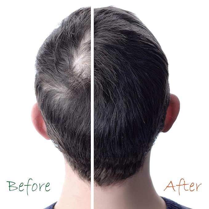 Hair Growth Booster Anti-Aging Serum B5-Vitamin Treatment (2 Pack) 6 oz - Non Sulfate Formula - for Color Treated Hair - Premium Thinning Solution - Growth for Men & Women | Organic Hair Energizer