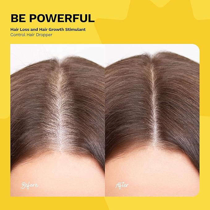 Ginger Root Extract | Growth Stimulating Drops and Hair Loss Control | Serum Vegan Energizing Hair Elixir | Be Powerful (4 fl oz)
