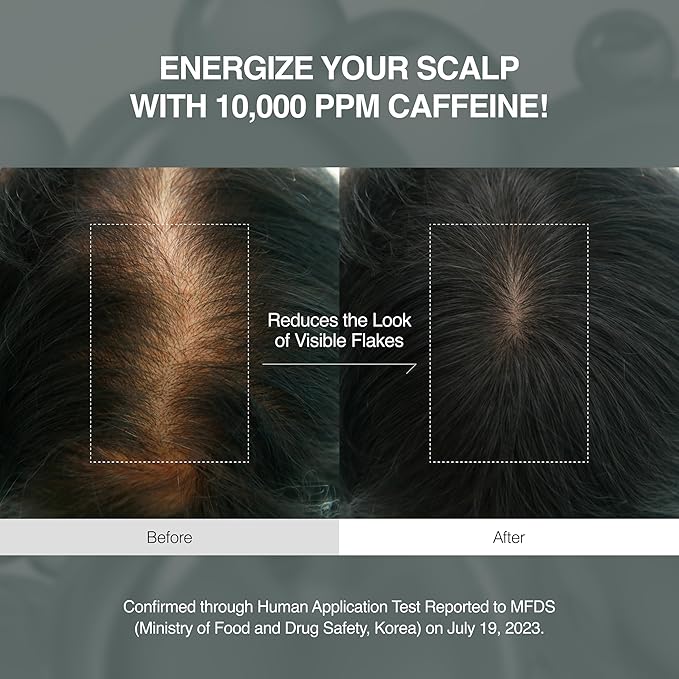 Korean Scalpy Hair Growth Serum for Women for Hair Loss & Thinning – Cooling & Refreshing Korean Hair Care For Oily, Lightweight, Treatment, Frizz Ease Serum, Hair loss, Anti Frizz, Hair Mask | Cooling & Refreshing, Clean Solution