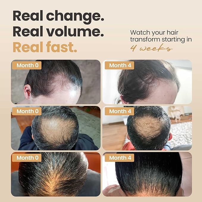Vitasei Hair Booster 2 Fl Oz (3 Pack) – Hair Revitalizing Serum with Capilia Longa, Wild Olive Stem Cells & Arginine – Peptide-Enriched Hair Tonic Supports Thicker, Stronger – For Women & Men